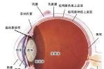 先天性眼球震顫