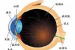 先天性眼球震顫