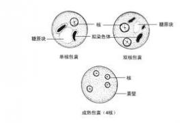 溶組織內阿米巴病