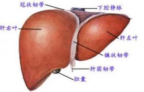 小兒肝硬化