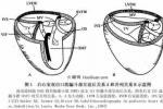 左心室雙出口