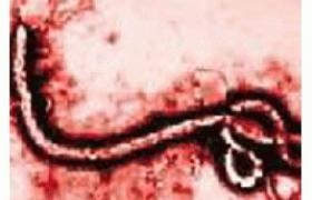 小兒埃博拉病毒病