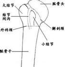 肱骨頭骨折