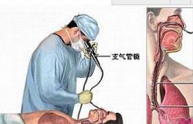 支氣管腺瘤