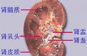 腎皮質髓質膿腫