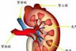 小兒急性腎小球腎炎