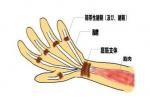 手部肌腱損傷