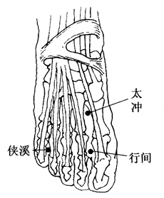 妊娠惡阻