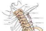 頸椎結核