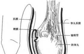 小兒睪丸扭轉