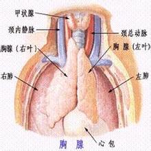 僵人綜合征