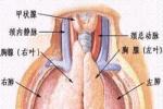 僵人綜合征