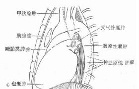 心包囊腫