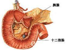 胰腺膿腫