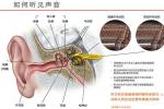 突發性耳聾