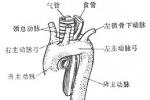 先天性主動脈弓畸形