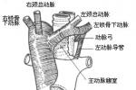 先天性主動脈弓畸形