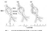 小兒陣發性心動過速