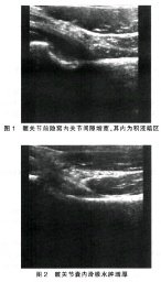 上呼吸道感染