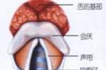 先天性喉喘鳴