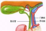 先天性膽道閉鎖