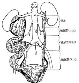 先天性巨輸尿管