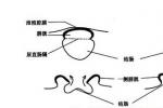 泄殖腔外翻