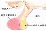 高催乳素血癥