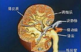 狼瘡性腎炎