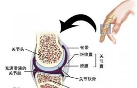 骨結核