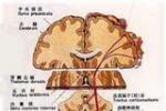 錐體外系疾病