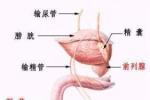 輸精管缺如