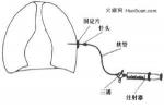 小兒膿胸