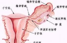 腎及輸尿管結石