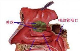 常年性鼻炎