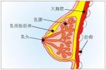 乳腺脂肪肉瘤