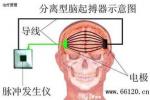 肌張力障礙綜合征