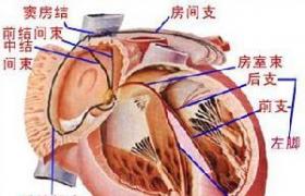 高度房室傳導阻滯