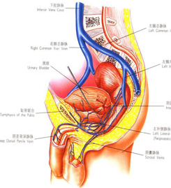 慢性盆腔炎