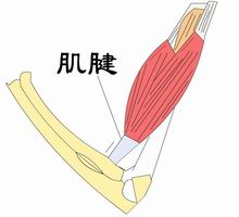 肱二頭肌長頭腱鞘炎