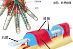 肱二頭肌長頭腱鞘炎