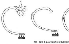 吸入性損傷