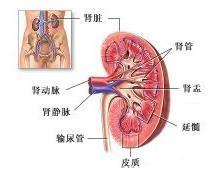 急性腎盂腎炎