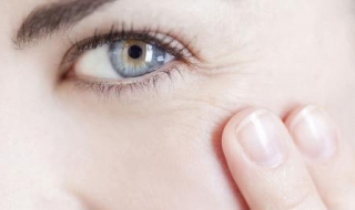 眼角幹紋怎麼辦 希望對你有幫助