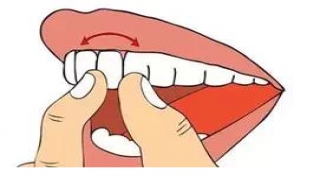 牙齒松動怎麼辦 及時就醫治療