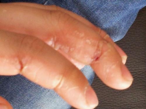 手指甲上的月牙是怎麼回事