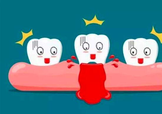 牙齦出血是什麼原因