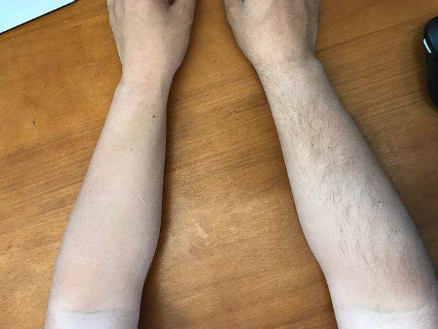 脫毛膏去腿毛好嗎