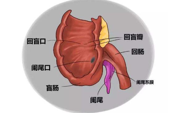 急性闌尾炎不能吃什麼