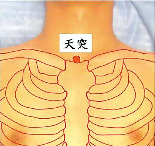 治療嗓子癢咳嗽的偏方
